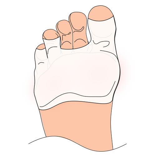 Foot pads cover the bottom of the foot to prevent blisters, sliding and sensitive feet in high heels and other fashion shoes shoes